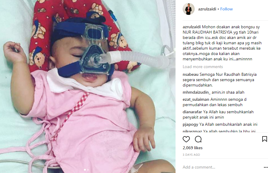 13 hari di icu ini perkembangan terkini anak pelawak azrul cham 2