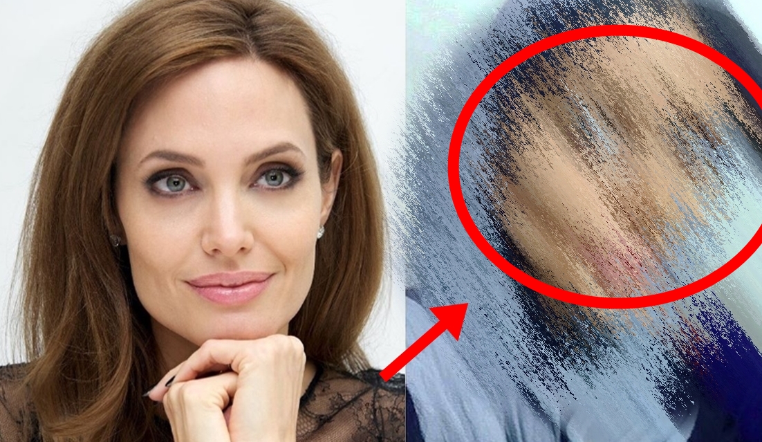 50 pembedahan untuk dapatkan wajah angelina jolie ini hasilnya yang mengejutkan 1