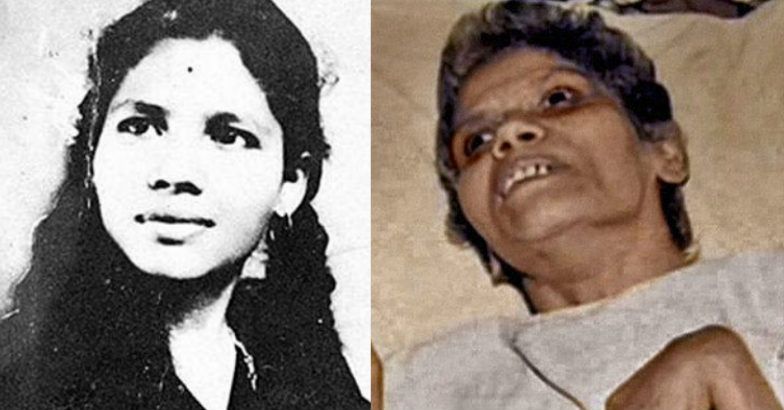 aruna shanbaug mangsa koma