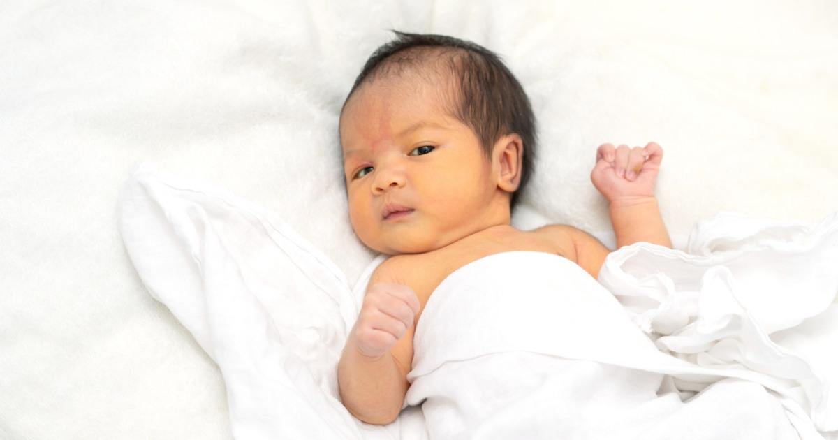 bayi baru lahir kena jaundice demam kuning