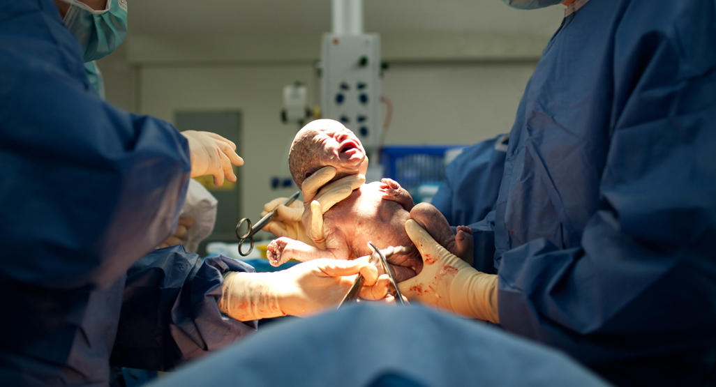 caesarean 2