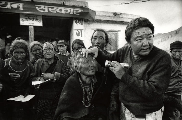 dr sanduk memeriksa mata pesakit di nepal pada tahun 1992