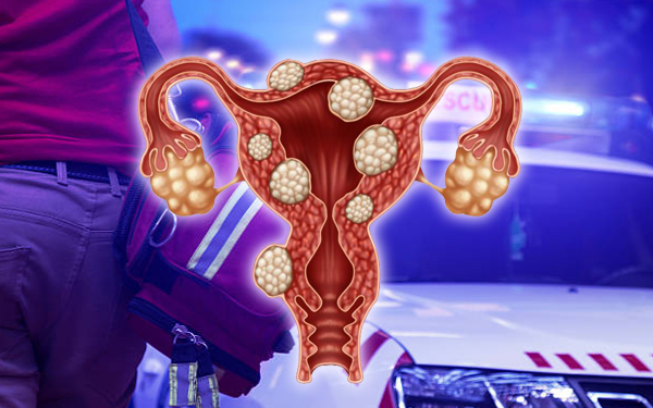 fibroid