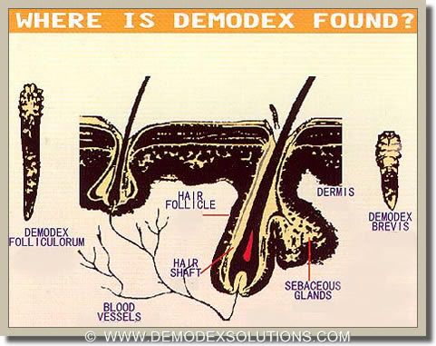 iluminasi demodex kutu wajah2 132