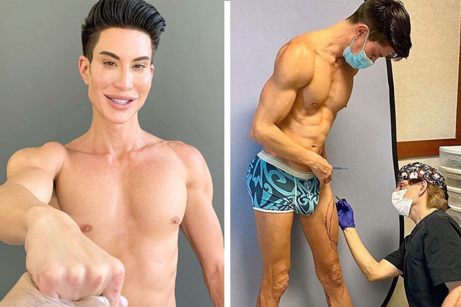 justin jedlica pembedahan plastik