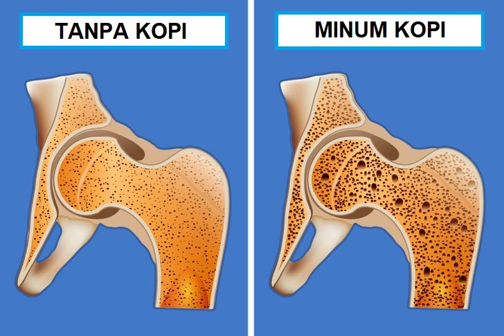 kopi buatkan mineral dalam badan hilang dengan cepat