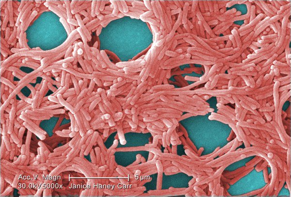 legionella pneumophila ini 7 organisma dalam air minuman anda setiap hari