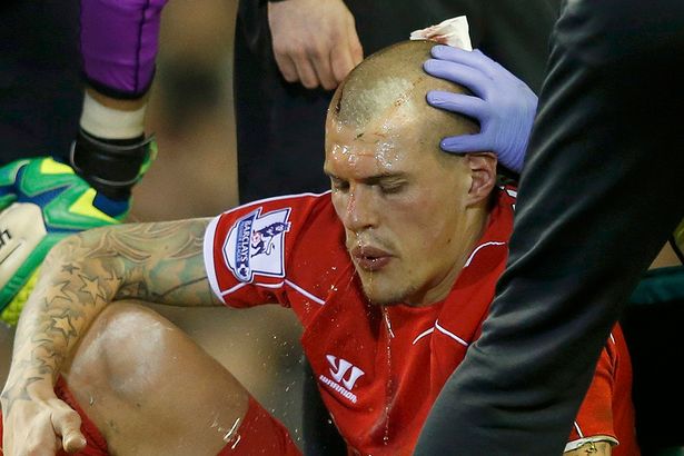 martin skrtel