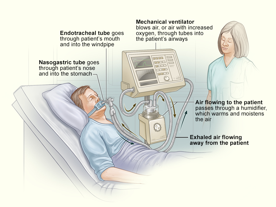 mekanisma ventilator 941