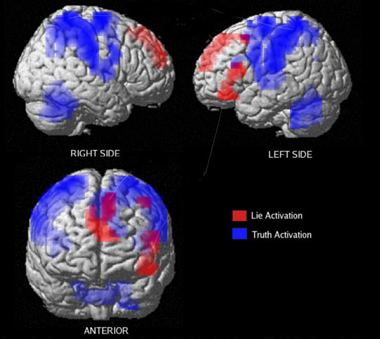 mesin imbasan fmri menunjukkan aktiviti otak depan apabila menipu