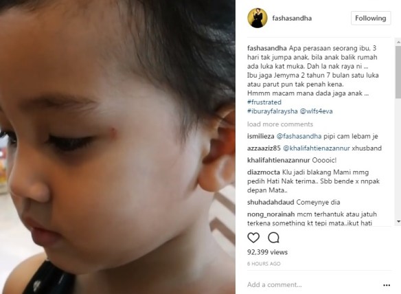 muka anak lebam fasha sandha buat pendedahan panas 2