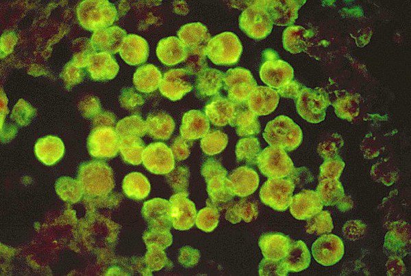 naegleria fowleri ini 7 organisma dalam air minuman anda setiap hari