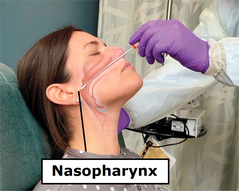 nasopharyngeal swab