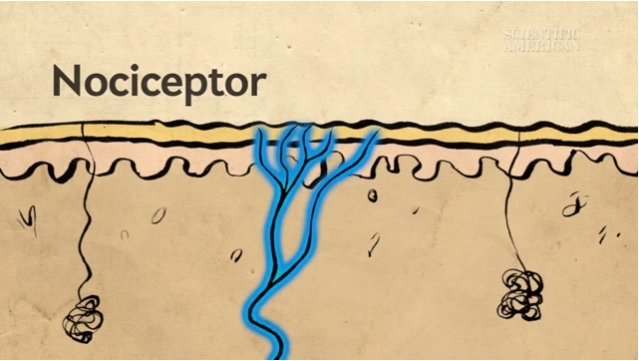 nociceptor