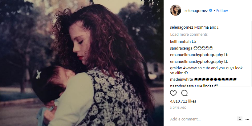 peminat terkejut lihat wajah ibu selena gomez 2