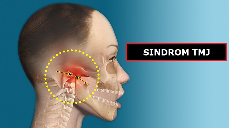 penyakit tmj
