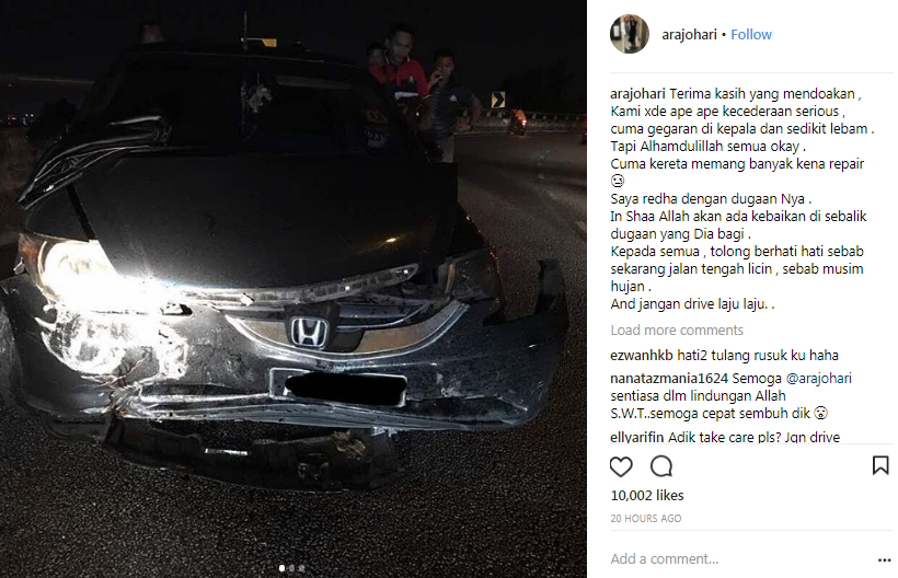 penyanyi ara johari kemalangan alami gegaran kepala 2