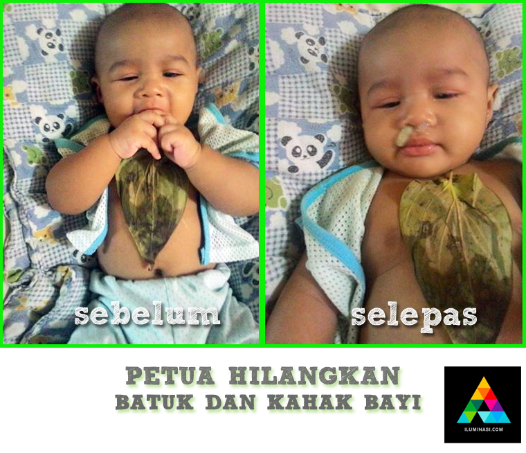 petua hilangkan batuk dan kahak