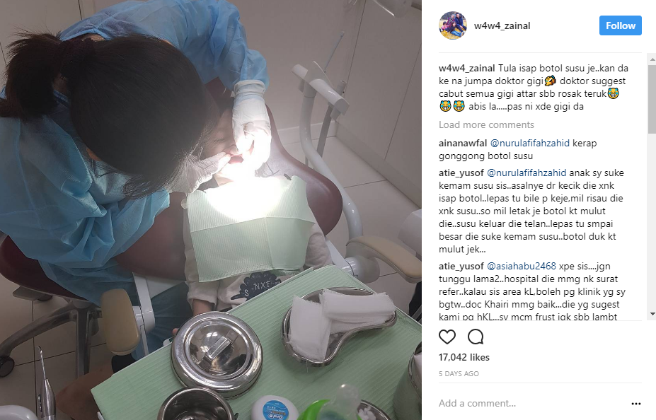 punca gigi anak wawa zainal attar perlu dicabut semua 1