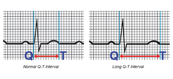 qt interval