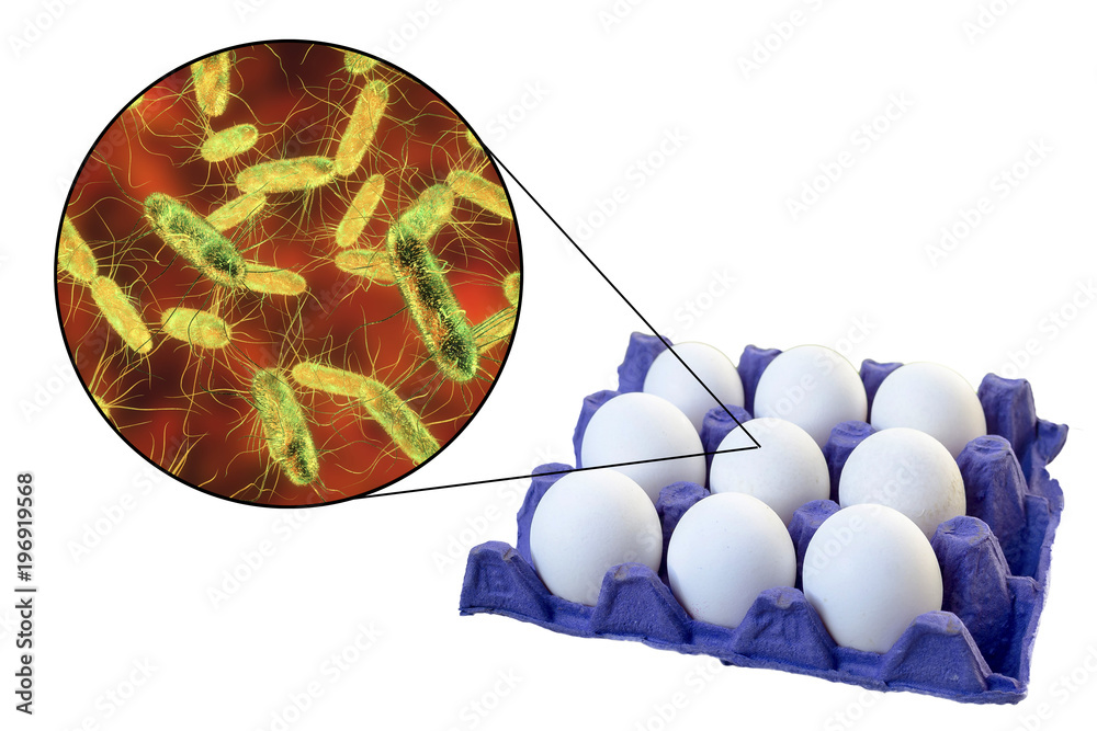 salmonellosis