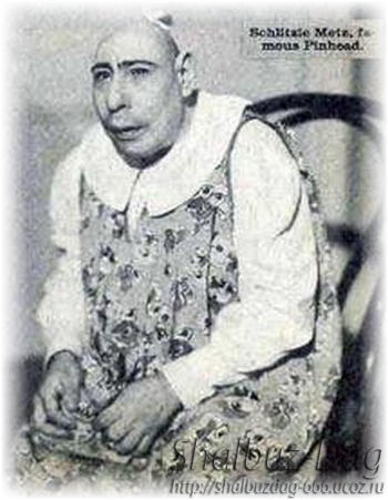 schlitzie