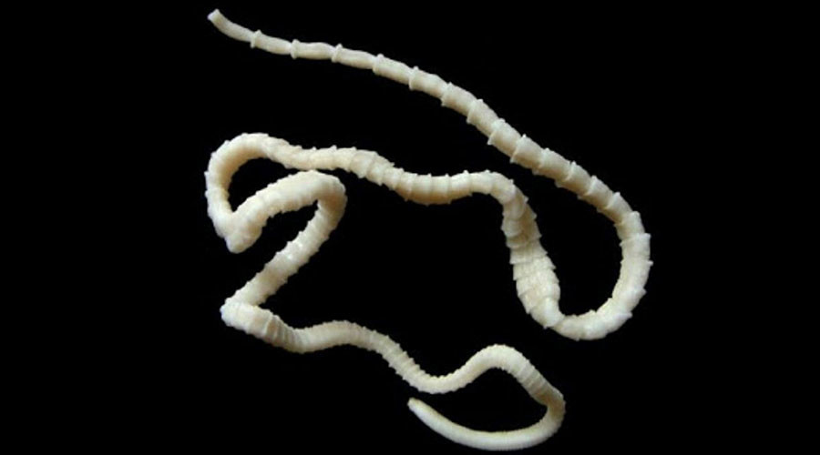 tapeworm