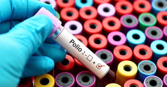 virus polio