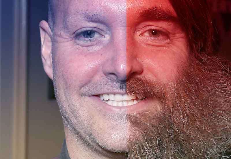 will forte muka sebelah