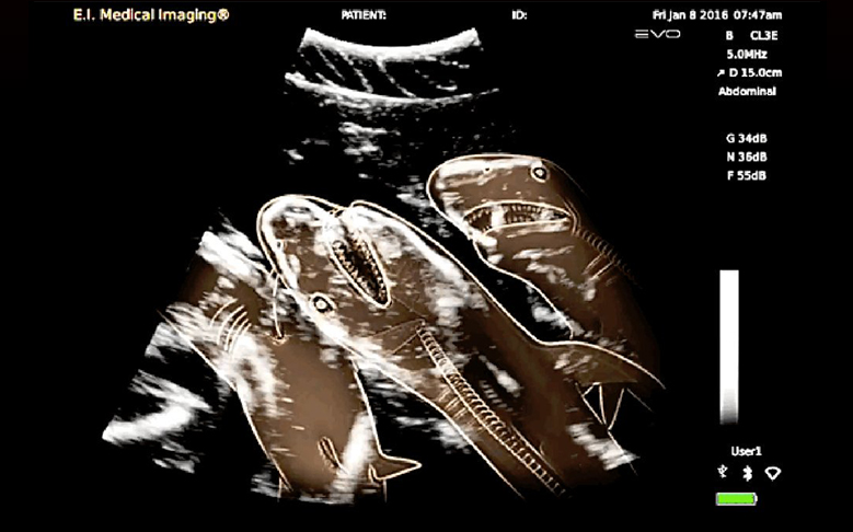 x ray ikan jerung