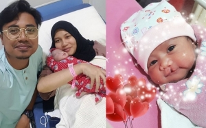 Malu Bayi Sumbing? Ini Respon Lan Solo