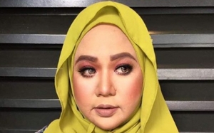 Ramai Terkejut Lihat Penampilan Enot Yang Sudah Kurus! (6 Gambar)